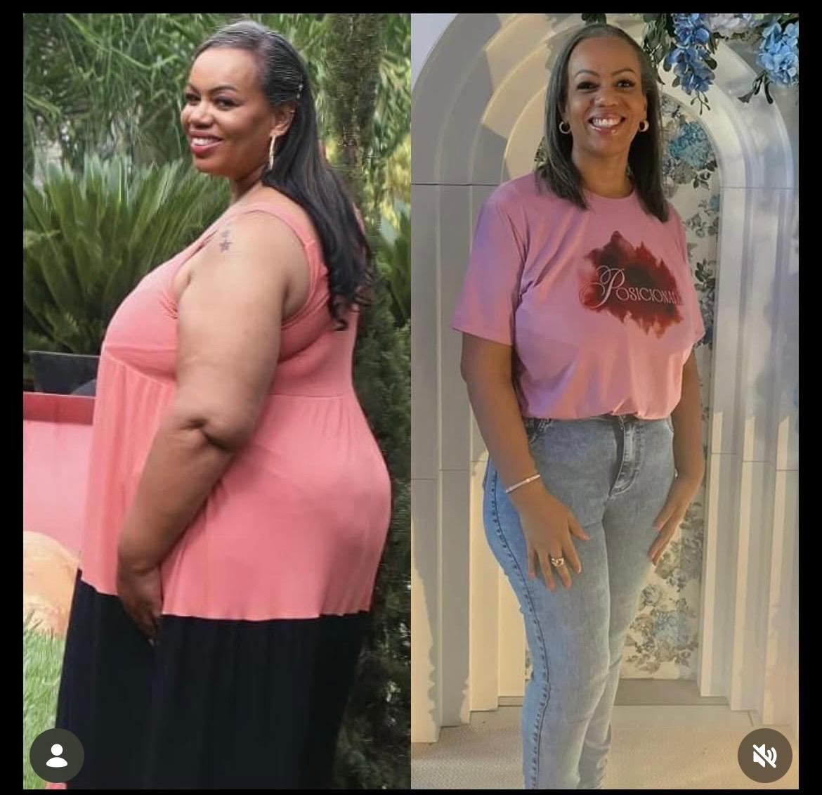 Resultado paciente — 14,8 kg eliminados